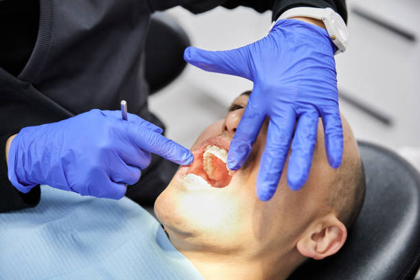 Best Broken or Chipped Tooth Repair in Winchester, VA